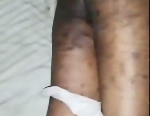 Edo Boy Records Infected Ass Of Lagos Ashawo With Big Ass (18+)